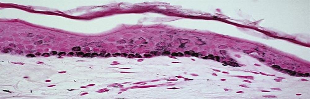 Skin Ageing and Pigmentation Cells_Pigmentation